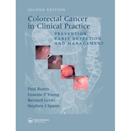 Colorectal Cancer in Clinical Practice: Prevention, Early Detection and Management, Second Edition