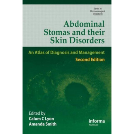 Abdominal Stomas and Their Skin Disorders