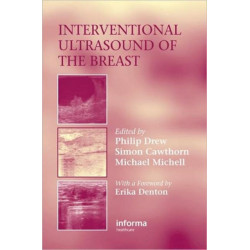 Interventional Ultrasound of the Breast