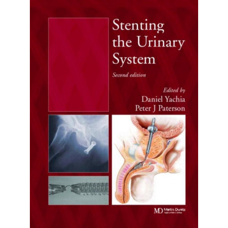 Stenting the Urinary System