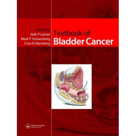 Textbook of Bladder Cancer
