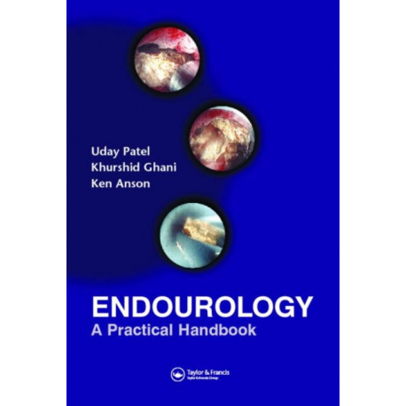 Endourology: A Practical Handbook