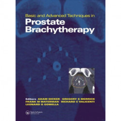 Basic and Advanced Techniques in Prostate Brachytherapy