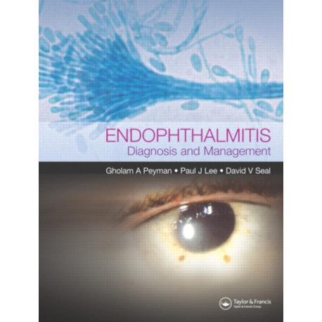 Endophthalmitis: Diagnosis and Treatment