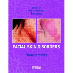 Facial Skin Disorders