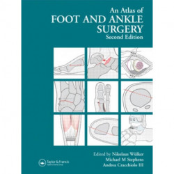 Atlas Foot and Ankle Surgery