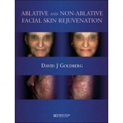 Ablative and Non-ablative Facial Skin Rejuvenation