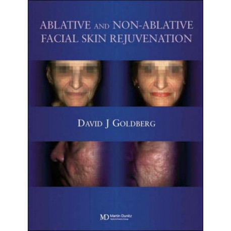 Ablative and Non-ablative Facial Skin Rejuvenation