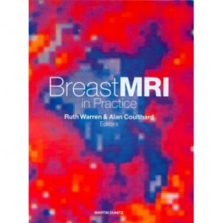 Breast MRI in Practice