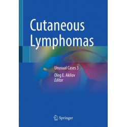 Cutaneous Lymphomas: Unusual Cases 3