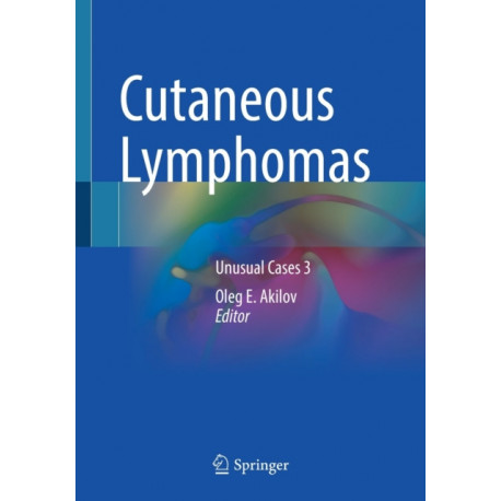 Cutaneous Lymphomas: Unusual Cases 3