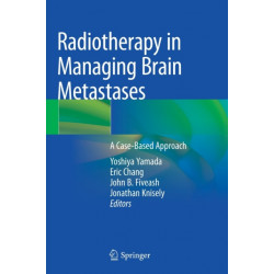 Radiotherapy in Managing Brain Metastases: A Case-Based Approach