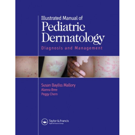 Illustrated Manual of Pediatric Dermatology: Diagnosis and Management