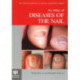 An Atlas of Diseases of the Nail