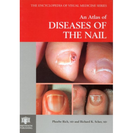 An Atlas of Diseases of the Nail