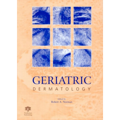 Geriatric Dermatology