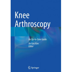Knee Arthroscopy: An Up-to-Date Guide