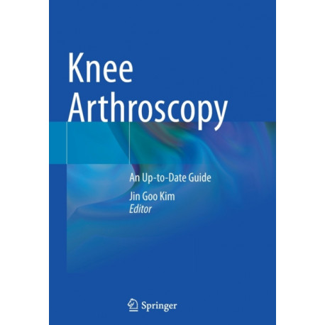 Knee Arthroscopy: An Up-to-Date Guide