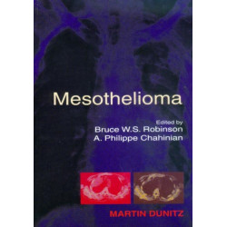Mesothelioma