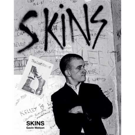 Skins: Gavin Watson
