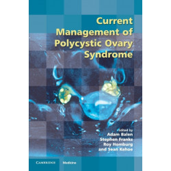 Current Management of Polycystic Ovary Syndrome
