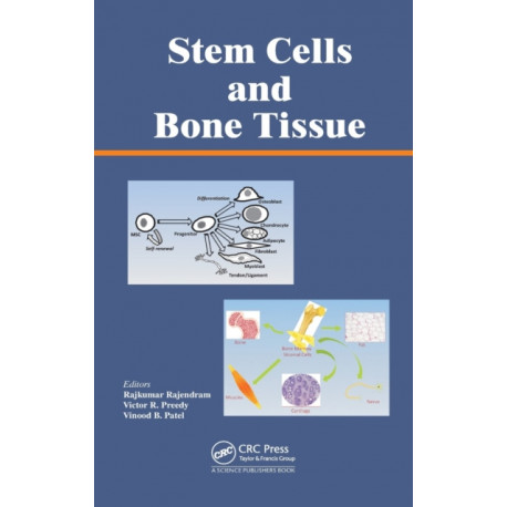 Stem Cells and Bone Tissue