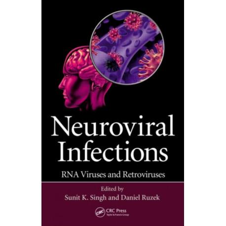 Neuroviral Infections: RNA Viruses and Retroviruses