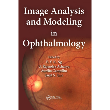 Image Analysis and Modeling in Ophthalmology