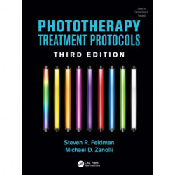 Phototherapy Treatment Protocols: Treatment Protocols