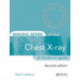 Making Sense of the Chest X-ray: A hands-on guide