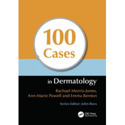 100 Cases in Dermatology