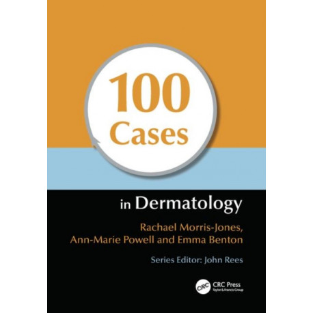 100 Cases in Dermatology