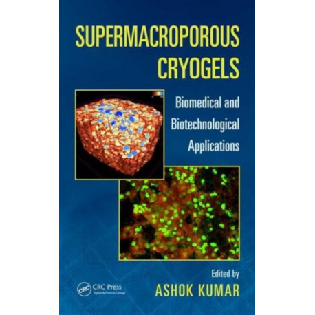 Supermacroporous Cryogels: Biomedical and Biotechnological Applications