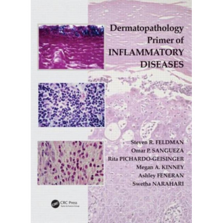 Dermatopathology Primer of Inflammatory Diseases