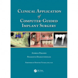 Clinical Application of Computer-Guided Implant Surgery