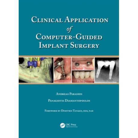 Clinical Application of Computer-Guided Implant Surgery