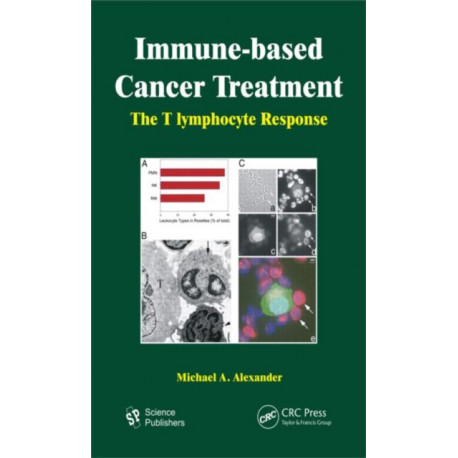 Immune-based Cancer Treatment: The T Iymphocyte Response