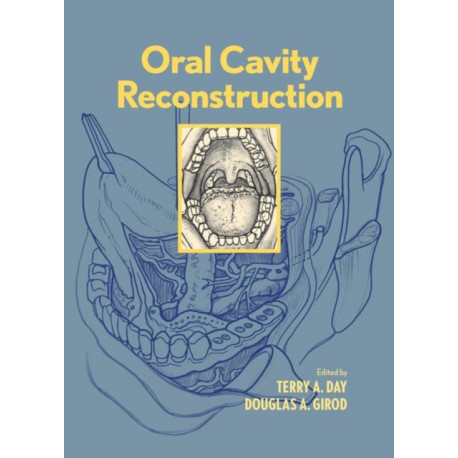 Oral Cavity Reconstruction