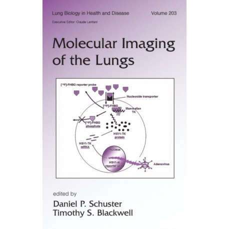 Molecular Imaging of the Lungs