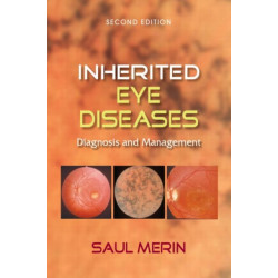 Inherited Eye Diseases: Diagnosis and Management