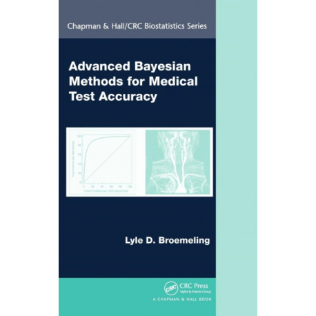 Advanced Bayesian Methods for Medical Test Accuracy