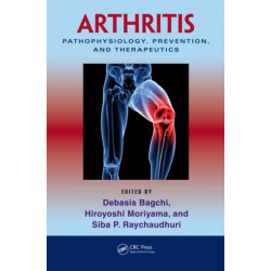 Arthritis: Pathophysiology, Prevention, and Therapeutics