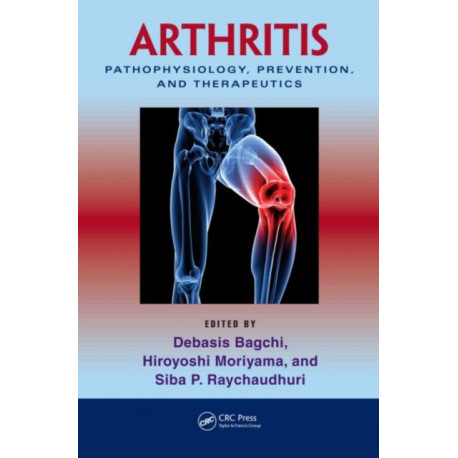 Arthritis: Pathophysiology, Prevention, and Therapeutics