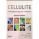 Cellulite: Pathophysiology and Treatment