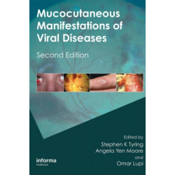 Mucocutaneous Manifestations of Viral Diseases: An Illustrated Guide to Diagnosis and Management