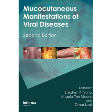 Mucocutaneous Manifestations of Viral Diseases: An Illustrated Guide to Diagnosis and Management