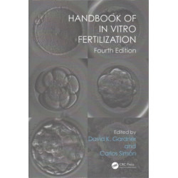 Handbook of In Vitro Fertilization