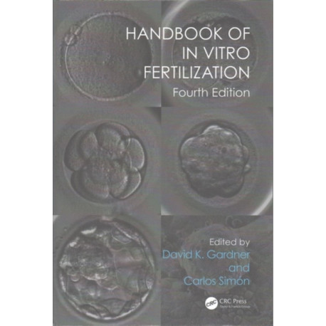 Handbook of In Vitro Fertilization