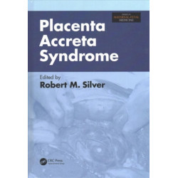 Placenta Accreta Syndrome