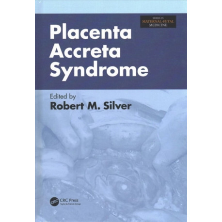 Placenta Accreta Syndrome